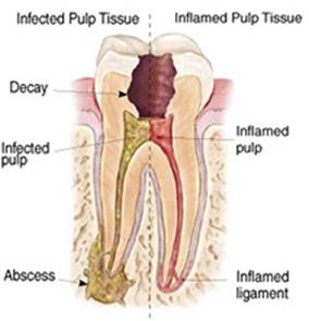 Endodontic Specialist of Oakhurst