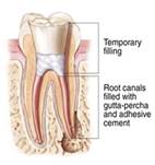 Endodontic Specialist of Oakhurst